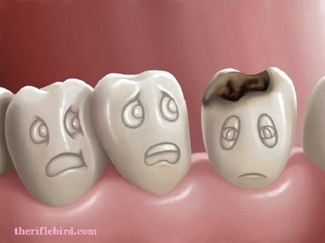 Curar las Caries 3 Formas Naturales