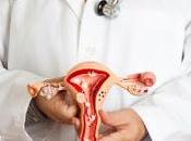 Cómo detectar tiempo Cáncer Ovarios Síntomas