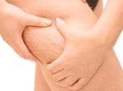 Ingredientes para evitar celulitis