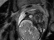 Visualizar parto través resonancia magnética