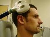 Estimulacion Magnetica Transcraneal mejora