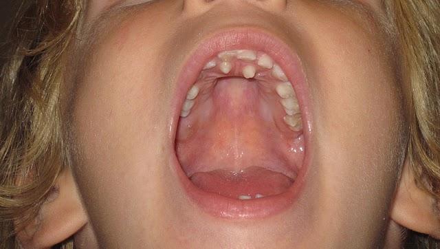 ¿Cuál es su diagnóstico?