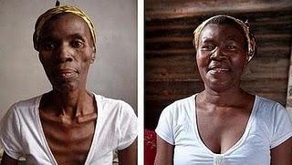 Los increíbles efectos restauradores de la terapia de fármacos antirretrovirales en personas con VIH