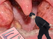 Cirugía amígdalas niños: ¿"sencilla" corta duración? Situación trabajo honorarios anestesiólogo infravalorados