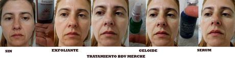 salud, belleza, cosmética, medicina alternativa, dietética, cosmética farmaceutica, Dietética Farmaceutica, BDV Farma, cosmética natural, blog de belleza, blog de cosmética, solo yo, blog solo yo, belleza, antiedad, acne, flacidez, bolsas, ojeras, arrugas, lineas de expresión, dermocosmética, complementos alimenticios, capilar, limpieza facial, perfumes, sequedad cutánea, manchas, cicatrices, envejecimiento de la piel, antiarrugas, puntos negros, piel atópica, articulaciones, cartilago, flexibilidad,