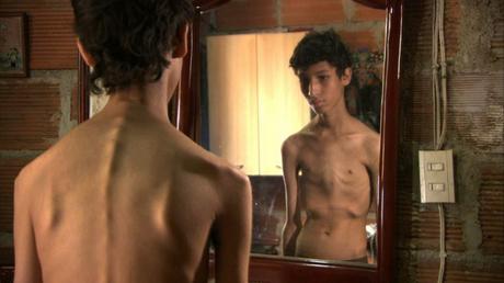 Desórdenes alimenticios: la anorexia y la bulimia