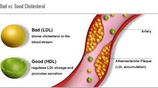 Qué es el colesterol y los mejores alimentos para combatirlo
