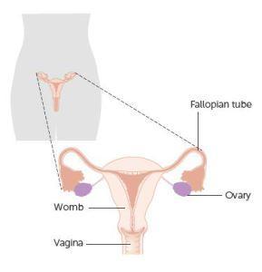 Ausencia de vagina