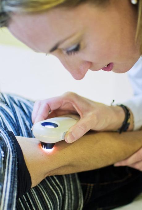 Diagnóstico precoz del cáncer en la piel