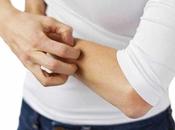 alergias comunes hacer deporte