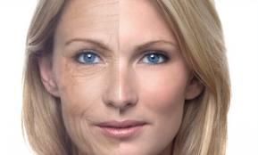 Arrugas faciales de expresión sin importar la edad
