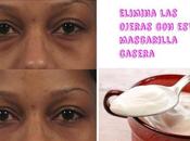 Elimina horribles ojeras estas mascarillas caseras