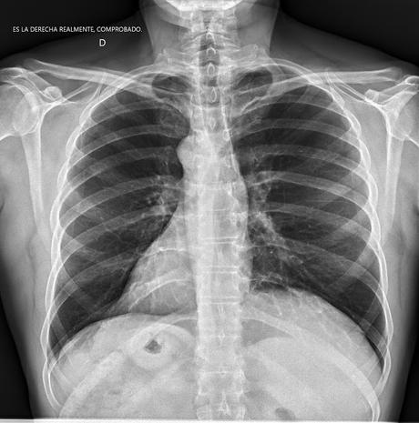 El paciente invertido