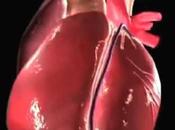 Insuficiencia Cardiaca Aumenta Riesgo Cancer