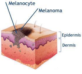 Dibujo04 La hiperpigmentación