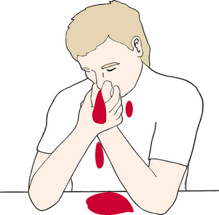 Mensaje a la comunidad de hemofilia