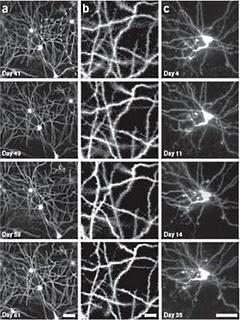 Nueva técnica para observar neuronas continuamente