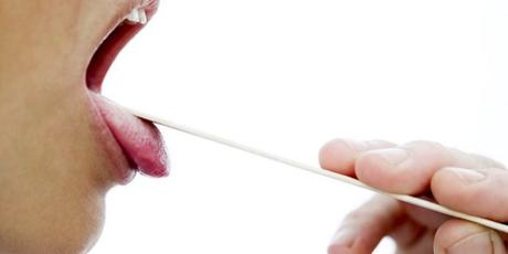 Inflamación de la garganta y las muelas del juicio