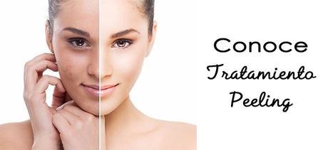 Conoce:  Peeling con Maystar y Phiris
