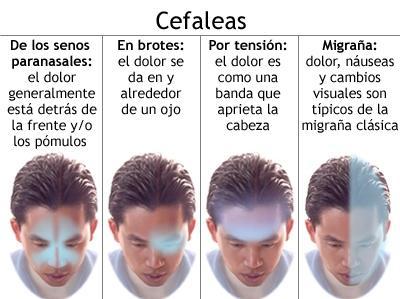 Hola, tengo migraña.