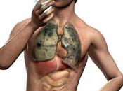 Enfermedades pulmonares: Enfisema humo tabaco