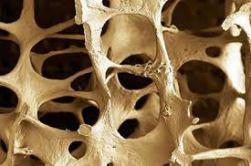 Osteoporosis y Osteopenia ¿Cuál es la diferencia?