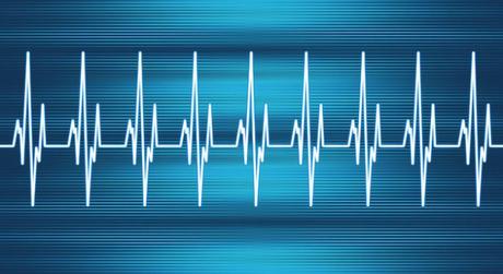 Palpitaciones del corazón: Causas, riesgos y tratamiento