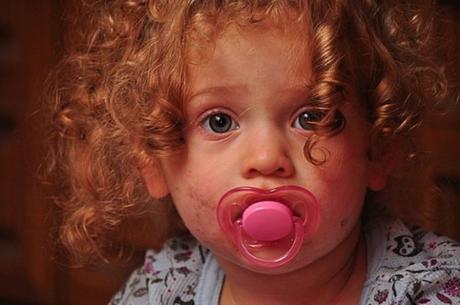 Chupete en edades avanzadas. Problemas