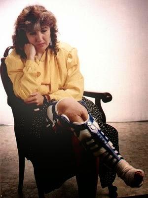 Reclamación al hospital reina Sofía Córdoba 14 años esperando para que me opere