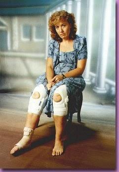 Reclamación al hospital reina Sofía Córdoba 14 años esperando para que me opere