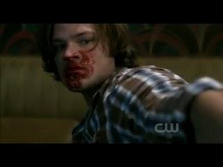 Supernatural 5x14