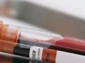 Diagnóstico Fibrosis Quística