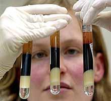 sangre N Descifrar un análisis de sangre. Parte II