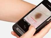 Convierte iPhone dermatoscopio profesional