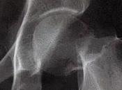 Proyecto 2.0: preguntas Traumatología