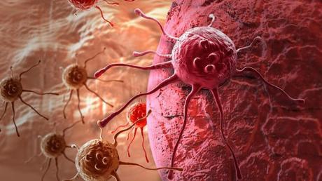 Sólo una prueba de PSA en la mediana edad puede predecir el riesgo futuro de cáncer de próstata Sólo una prueba de PSA en la mediana edad puede predecir el riesgo futuro de cáncer de próstata