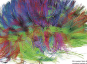 Tenemos nueva imagen cerebro