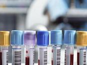 Sepsis: asesino silencioso