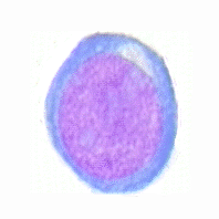 Tecnica de Edicion de Genes Solucionaria problemas Hematologicos