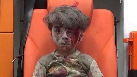 Crisis humanitaria … en Alepo este: Sólo quedan 30 médicos para atender a 250.000 personas.