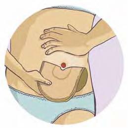 Por la Ostomía, ¡muévete!