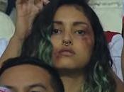 #RojaALaViolencia, campaña vivo retransmisión partido