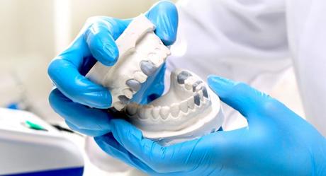 ¿Qué tipo de corona es lo mejor para los dientes?