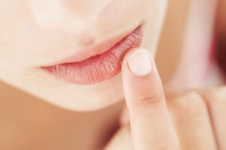 cuidado labios agrietados