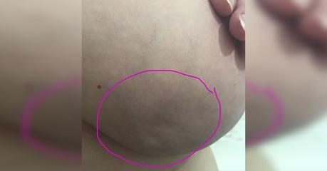 esta-sutil-senal-en-tu-cuerpo-puede-ser-el-sintoma-de-una-grave-enfermedad