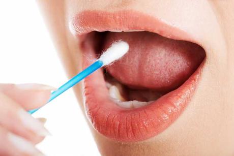 Trastornos de ansiedad: un test por saliva encuentra el medicamento más preciso – La Nación