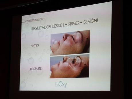 BEOXY FACIAL: UN SOPLO DE OXÍGENO PURO EN TU ROSTRO