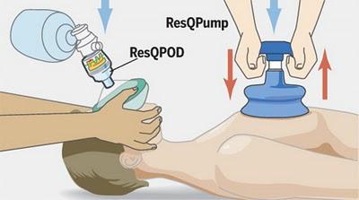 La reanimación cardiopulmonar está cambiando... y mucho