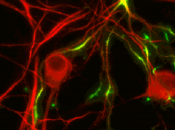 nuevo camino para antidepresivos