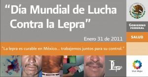 imagen cuadro D 300x157 Día mundial contra la lepra 31 de enero